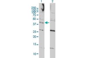 Western Blot analysis of CCNK expression in transfected 293T cell line by CCNK monoclonal antibody (M01), clone 3B7-1B9. (Cyclin K Antikörper  (AA 1-354))