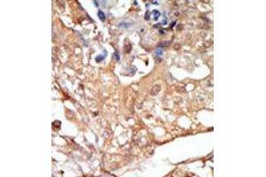 Image no. 2 for anti-V-Raf-1 Murine Leukemia Viral Oncogene Homolog 1 (RAF1) (N-Term) antibody (ABIN360145) (RAF1 Antikörper  (N-Term))