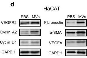 Effect of ASC-MV treatment on gene expression in all three kinds of cells. (VEGFR2/CD309 Antikörper  (AA 1150-1250))