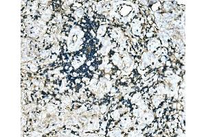 IHC analysis of MEF2B using anti-MEF2B antibody (ABIN7599892). (MEF2B Antikörper  (AA 127-352))