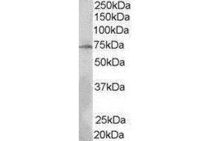 Western Blotting (WB) image for anti-SH2B Adaptor Protein 3 (SH2B3) (N-Term) antibody (ABIN2475350) (SH2B3 Antikörper  (N-Term))