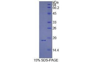 SDS-PAGE analysis of Human Cyclophilin A Protein. (PPIA Protein)