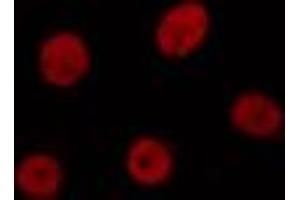 ABIN6274371 staining HuvEc cells by IF/ICC. (MED1 Antikörper  (C-Term))