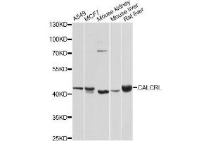Western blot analysis of extracts of various cell lines, using CALCRL antibody. (CALCRL Antikörper  (AA 392-461))