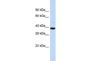 Host:  Rabbit  Target Name:  NOX4  Sample Type:  MCF7 Whole Cell lysates  Antibody Dilution:  1. (NADPH Oxidase 4 Antikörper  (Middle Region))