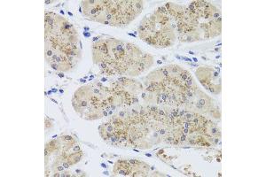 Immunohistochemistry of paraffin-embedded human stomach using MTERFD3 antibody (ABIN5974877) at dilution of 1/100 (40x lens). (MTERFD3 Antikörper)
