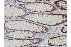Image no. 1 for anti-WNK Lysine Deficient Protein Kinase 2 (WNK2) (AA 2118-2218) antibody (ABIN599299) (WNK2 Antikörper  (AA 2118-2218))