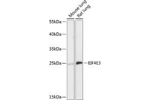 Western blot analysis of extracts of various cell lines, using EIF4E3 antibody (ABIN6130367, ABIN6140088, ABIN6140089 and ABIN6218034) at 1:3000 dilution. (EIF4E3 Antikörper  (AA 1-118))