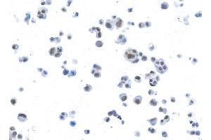 Immunocytochemistry (ICC) image for anti-Bromodomain Containing 3 (BRD3) (AA 676-726) antibody (ABIN7454022) (Rekombinanter BRD3 Antikörper  (AA 676-726))