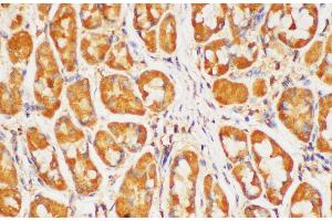 Immunohistochemistry of paraffin-embedded Human stomach using HRAS Polycloanl Antibody at dilution of 1:200 (HRAS Antikörper)