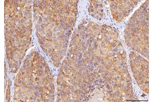 IHC analysis of Sorbitol Dehydrogenase/SORD using anti-Sorbitol Dehydrogenase/SORD antibody (ABIN7602485). (SORD Antikörper  (AA 8-357))