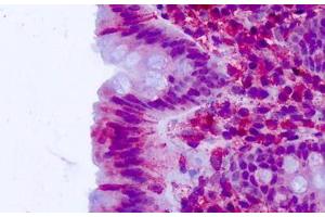 Immunohistochemistry (IHC) image for anti-Cadherin EGF LAG Seven Pass G-Type Receptor 2 (CELSR2) (N-Term) antibody (ABIN1048429)