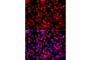 Immunofluorescence analysis of A549 cells using FASN antibody. (Fatty Acid Synthase Antikörper)