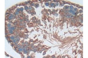 Immunohistochemistry (IHC) image for anti-Selectin P (Granule Membrane Protein 140kDa, Antigen CD62) (SELP) (AA 58-158) antibody (ABIN7432088)