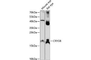 CRYGB Antikörper  (AA 80-135)