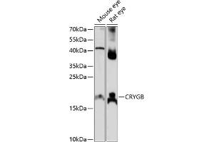 Western blot analysis of extracts of various cell lines, using CRYGB antibody (ABIN7266531) at 1:1000 dilution.
