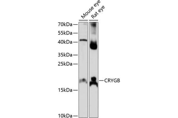 CRYGB Antikörper  (AA 80-135)