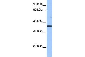 WB Suggested Anti-FAM153B Antibody Titration: 0. (FAM153B Antikörper  (Middle Region))