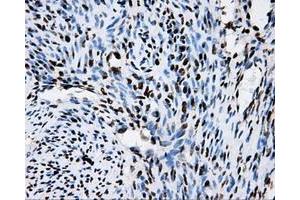 Image no. 19 for anti-Replication Protein A2, 32kDa (RPA2) antibody (ABIN1500733)