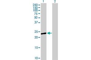 Western Blot analysis of PRTFDC1 expression in transfected 293T cell line by PRTFDC1 MaxPab polyclonal antibody. (PRTFDC1 Antikörper  (AA 1-225))