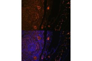 Immunofluorescence analysis of rat oophoroma cells using ZP3 antibody (ABIN6130818, ABIN6150537, ABIN6150539 and ABIN6224382) at dilution of 1:100. (Zona Pellucida Glycoprotein 3 Antikörper  (AA 170-390))