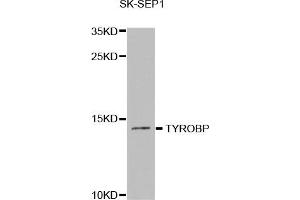 Western Blotting (WB) image for anti-TYRO Protein tyrosine Kinase Binding Protein (TYROBP) antibody (ABIN1876573) (TYROBP Antikörper)