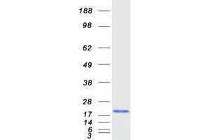 Validation with Western Blot