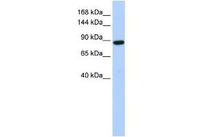 WB Suggested Anti-HACE1 Antibody Titration:  0. (HACE1 Antikörper  (Middle Region))