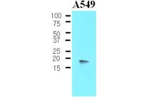 Western Blotting (WB) image for anti-Protein Phosphatase 1, Regulatory (Inhibitor) Subunit 14A (PPP1R14A) (AA 1-147), (N-Term) antibody (ABIN302213) (CPI-17 Antikörper  (N-Term))