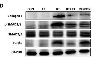 Increased DIO2 expression in lung tissue after radiation treatment and inhibition of the TGF-β1 signaling pathway by thyroid hormone. (GAPDH Antikörper)