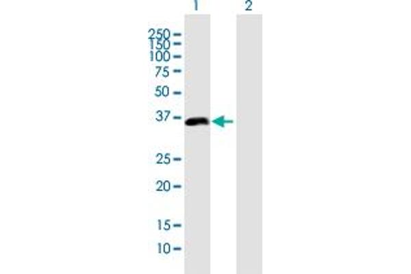 PDLIM2 Antikörper  (AA 1-352)