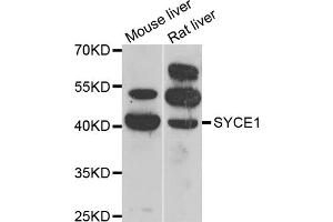 Western blot analysis of extracts of various cell lines, using SYCE1 antibody (ABIN5974347) at 1/1000 dilution. (SYCE1 Antikörper)