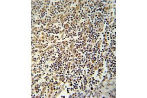 Immunohistochemistry (Paraffin-embedded Sections) (IHC (p)) image for anti-NLR Family, Pyrin Domain Containing 3 (NLRP3) (AA 65-91), (N-Term) antibody (ABIN652504)