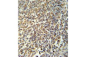 NLRP3 Antibody (N-term) (ABIN652504 and ABIN2842339) immunohistochemistry analysis in formalin fixed and paraffin embedded human lymph tissue followed by peroxidase conjugation of the secondary antibody and DAB staining.
