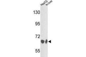Western Blotting (WB) image for anti-Complement Factor B (CFB) antibody (ABIN3003162) (Complement Factor B Antikörper)
