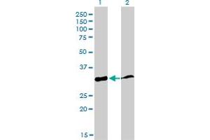 Western Blot analysis of PPIE expression in transfected 293T cell line by PPIE monoclonal antibody (M02), clone 2F5. (PPIE Antikörper  (AA 2-100))