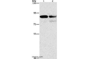 Western blot analysis of A431 and Raji cell, using CD2AP Polyclonal Antibody at dilution of 1:1000