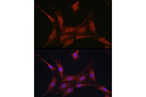 Immunofluorescence analysis of C6 cells using SLC4 / NBC Rabbit pAb (ABIN6129130, ABIN6148013, ABIN6148014 and ABIN6220962) at dilution of 1:100 (40x lens). (SLC4A4 Antikörper  (AA 1-240))
