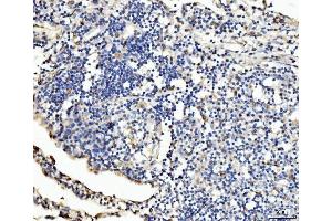 IHC analysis of PLD3 using anti-PLD3 antibody (ABIN7599439). (PLD3 Antikörper  (AA 1-490))