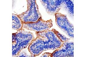 IHC analysis of PXDN using anti-PXDN antibody (ABIN7603819).