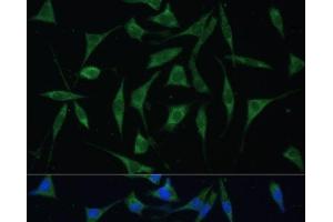 Immunofluorescence analysis of L929 cells using PALD1 Polyclonal Antibody at dilution of 1:100 (40x lens). (KIAA1274 Antikörper)