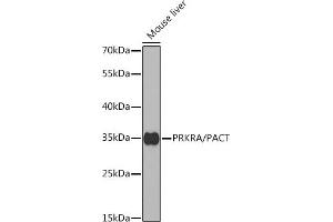 Western blot analysis of extracts of mouse liver, using PRKRA/PACT antibody (ABIN6130639, ABIN6146220, ABIN6146221 and ABIN6221069) at 1:1000 dilution. (PRKRA Antikörper  (AA 1-313))