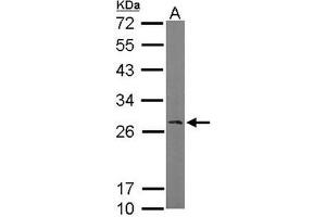 AP19035PU-N Ran BP1 antibody staining of Mouse brain (A) whole cell lysate (50 µg) at 1/1000 dilution, 12% SDS PAGE. (RANBP1 Antikörper  (N-Term))