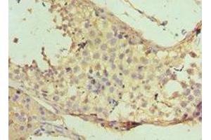 Immunohistochemistry of paraffin-embedded human testis tissue using ABIN7160732 at dilution of 1:100 (PTPDC1 Antikörper  (AA 161-235))