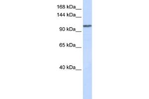 WB Suggested Anti-WDR63 Antibody Titration: 0. (WDR63 Antikörper  (Middle Region))