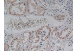 IHC-P analysis of Human Kidney Tissue, with DAB staining. (ABCC8 Antikörper  (AA 679-929))