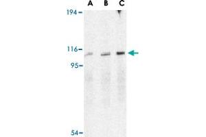 Western blot analysis of ERN1 in A-20 cell lysate with ERN1 polyclonal antibody  at (A) 0.