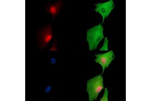ABIN7097004 and ABIN7101071 staining  cells by IF/ICC. (ARIP4 Antikörper)
