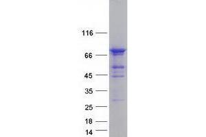 Validation with Western Blot (WRAP53 Protein (Transcript Variant 4) (Myc-DYKDDDDK Tag))