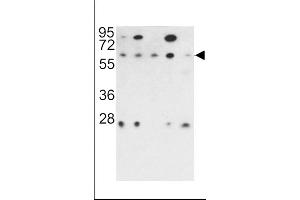 Western Blotting (WB) image for anti-Protein Phosphatase 2A 48 KDa Regulatory Subunit (PPP2R3B) (AA 25-54), (N-Term) antibody (ABIN392195)